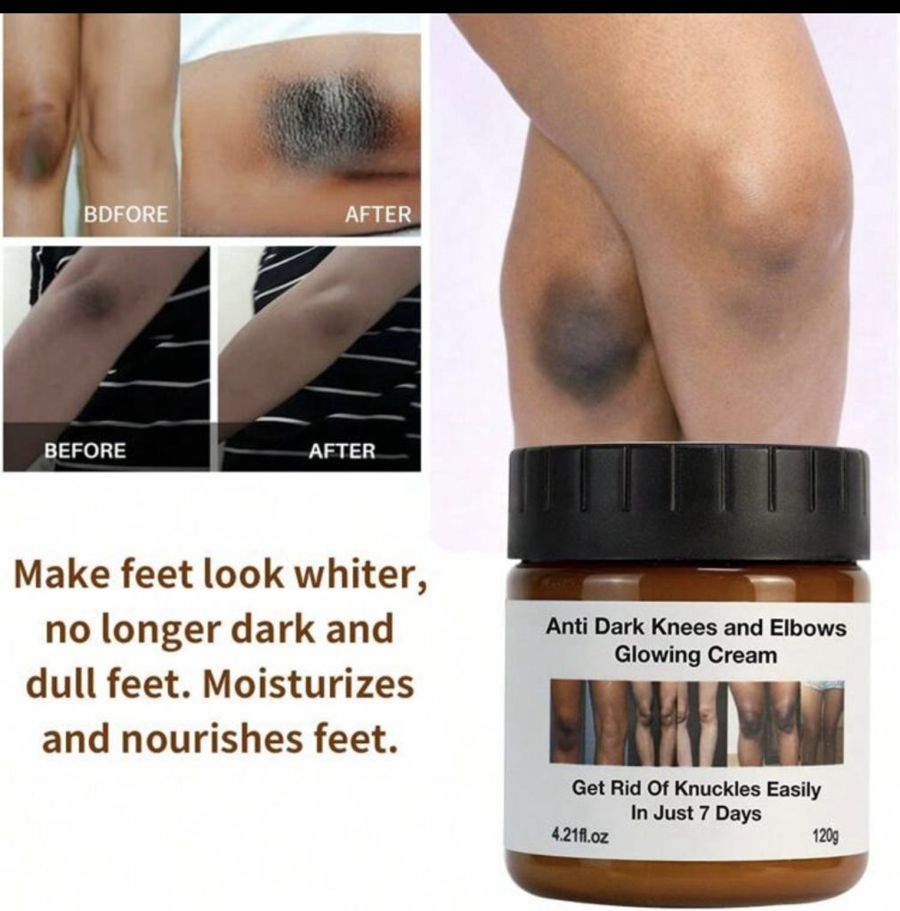 Anti Dark Knuckles